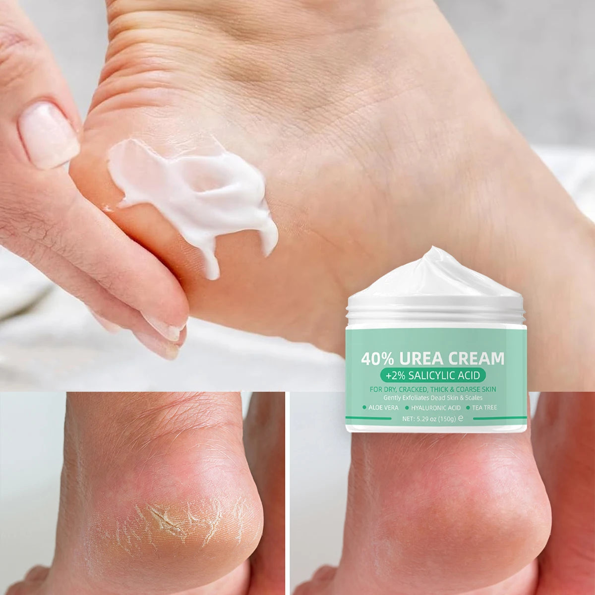 Creme de Ureia 40% + Glicerina 2% - Anti-Rachaduras para Pés e Corpo 150g