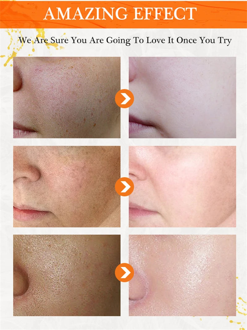 Creme Facial Vitamina C Iluminador - Anti-Idade e Firmeza