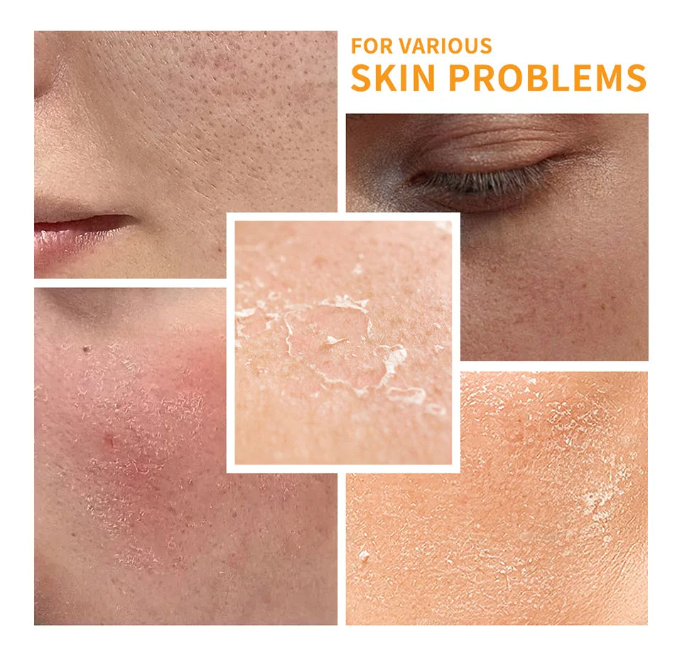 Set Vitamina C Completo - 6 Peças com Protetor Solar e Hidratação Profunda