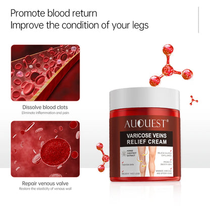 Creme Eficaz Varizes - Alívio Vasculite Flebite Pernas Pés Capilares