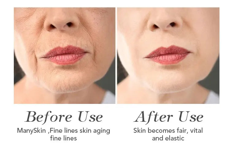 AILKE face cream Roe Essence Anti-Aging Wrinkle Brightening Moisturizing Whitening Freckles women beauty skin HOT Facial care
