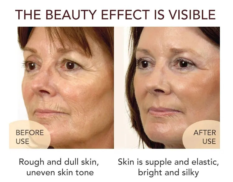 AILKE face cream Roe Essence Anti-Aging Wrinkle Brightening Moisturizing Whitening Freckles women beauty skin HOT Facial care
