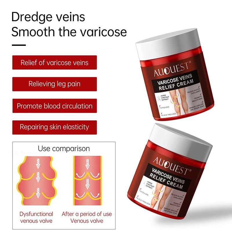 Creme Eficaz Varizes - Alívio Vasculite Flebite Pernas Pés Capilares