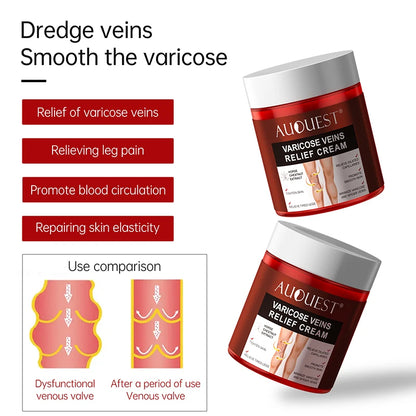 Creme Eficaz Varizes - Alívio Vasculite Flebite Pernas Pés Capilares