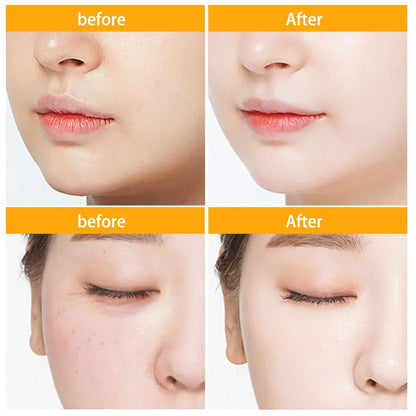 Cápsulas de Ácido Hialurónico 30 Peças - Sérum Hidratante Reparador e Firmador Facial