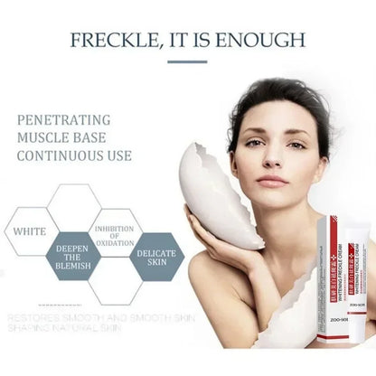 Pack 5 Cremes Clareadores 20g - Anti-Manchas Melasma Sardas LANBENA