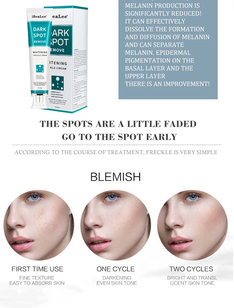 Creme Clareador Anti-Sardas EELHOE 20ml - Remove Melasma Manchas Escuras