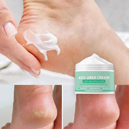 Creme de Ureia 40% + Glicerina 2% - Anti-Rachaduras para Pés e Corpo 150g