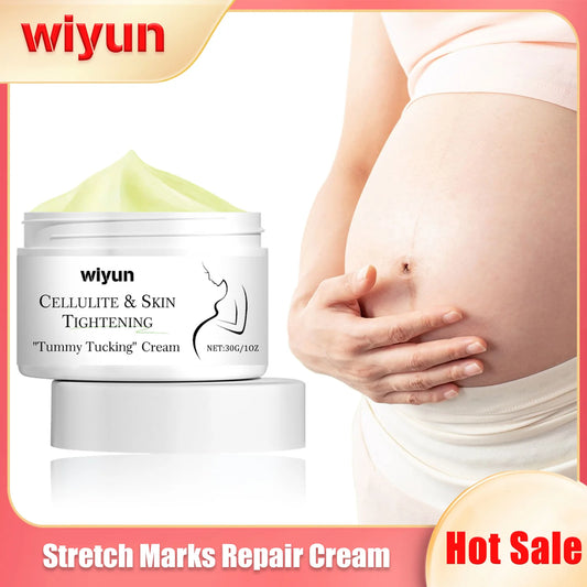 Creme Removedor de Estrias WIYUN 30g - Reparador Anti-Envelhecimento para Grávidas