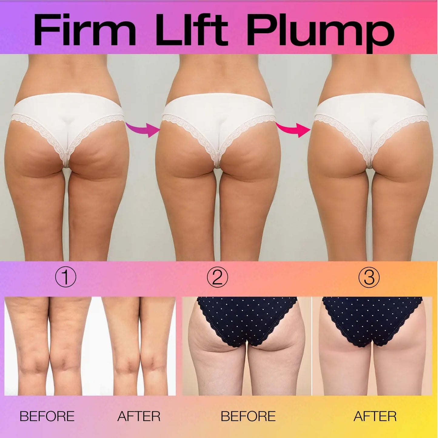 Creme Firmador para Glúteos TIGHT 100ml - Lifting e Redução de Celulite
